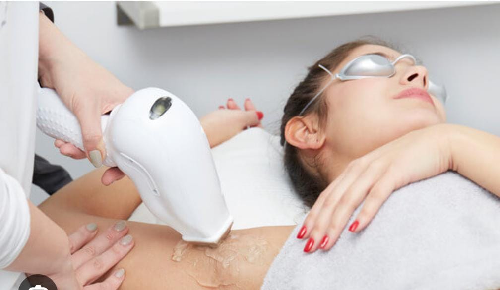 Laser Hair Removal